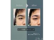 ☆メンズアイブロウ